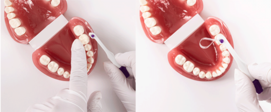 Medicom® SafeMatrix Clear Contour